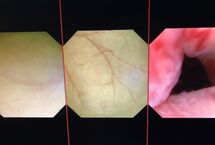 Urodynamics