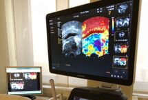 High-resolution sonography